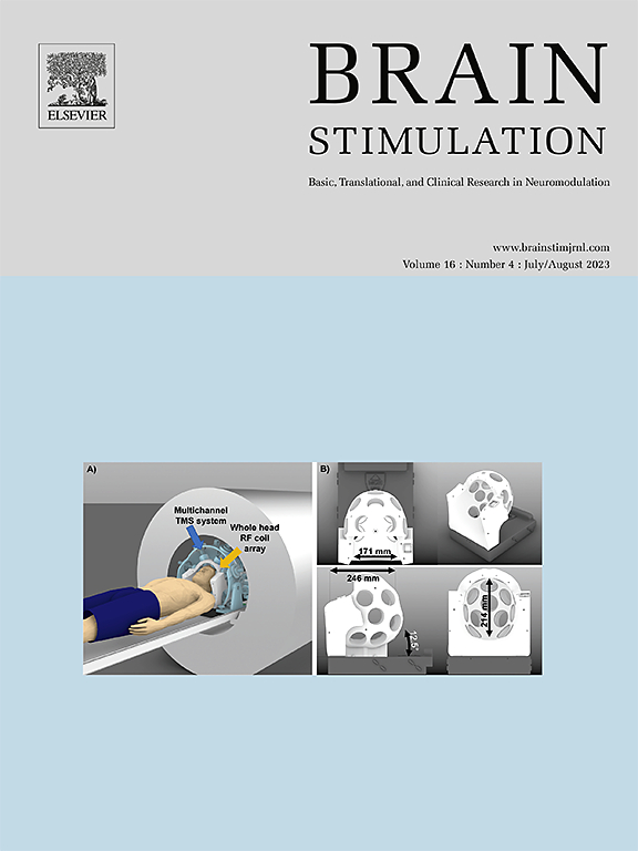 Brain Stimulation: 优点疗法有望为卒中后失语症患者带来新希望