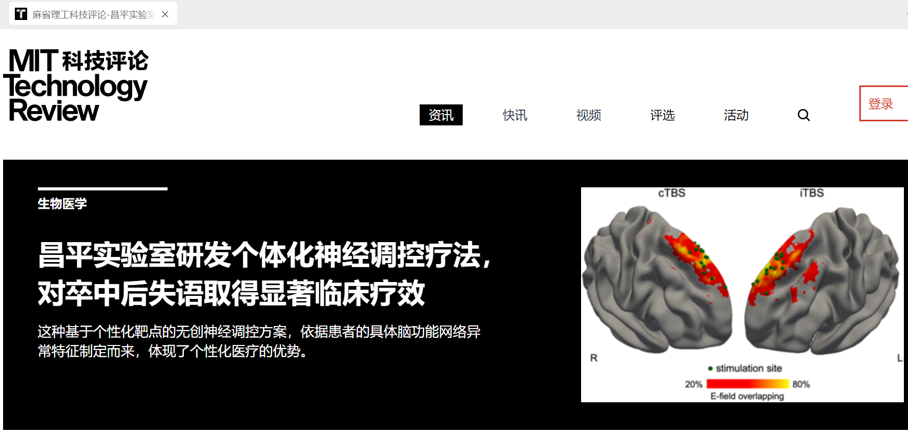MIT科技评论:个体化神经调控疗法,对卒中后失语取得显著临床疗效